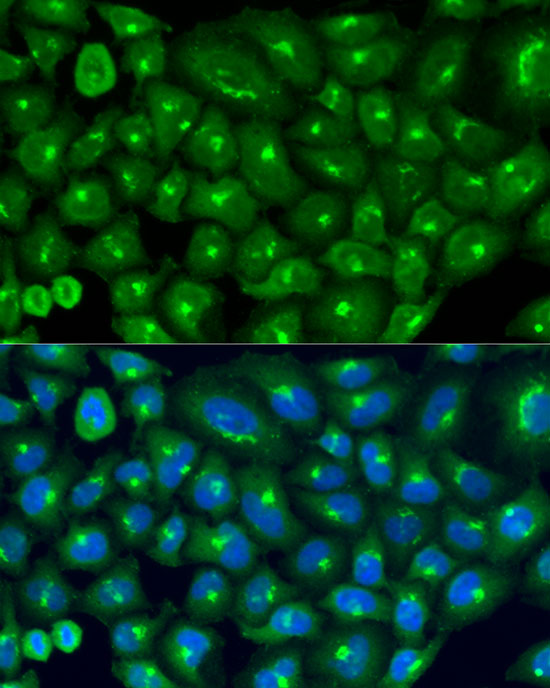 Immunofluorescence analysis of U2OS cells using COG7 Polyclonal Antibody at dilution of 1:100 (40x lens). Blue: DAPI for nuclear staining.