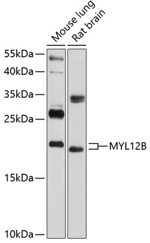 Western blot analysis of extracts of various cell lines using MYL12B Polyclonal Antibody at 1:1000 dilution.