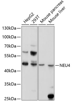 Western blot analysis of extracts of various cell lines using NEU4 Polyclonal Antibody at 1:1000 dilution.