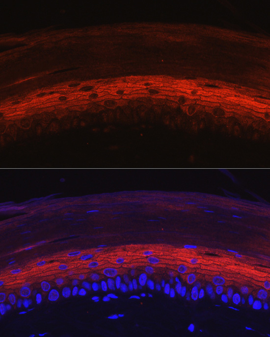 Immunofluorescence analysis of rat skin using KRT80 Polyclonal Antibody at dilution of 1:50 (40x lens). Blue: DAPI for nuclear staining.