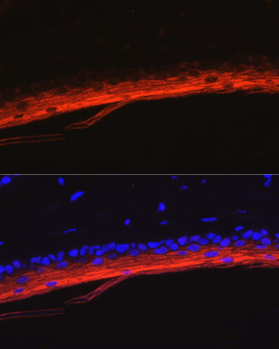 Immunofluorescence analysis of mouse skin using KRT80 Polyclonal Antibody at dilution of 1:50 (40x lens). Blue: DAPI for nuclear staining.