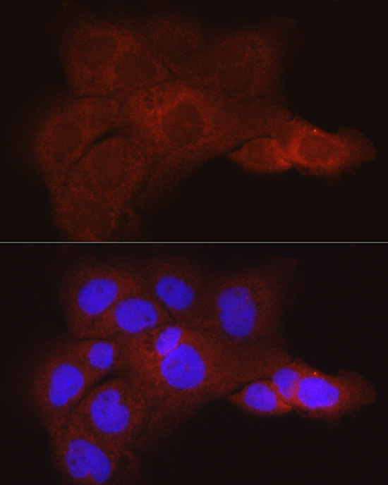 Immunofluorescence analysis of A431 cells using KRT80 Polyclonal Antibody at dilution of 1:50 (40x lens). Blue: DAPI for nuclear staining.