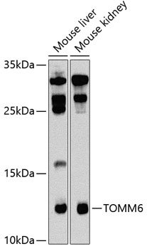 Western blot analysis of extracts of various cell lines using TOMM6 Polyclonal Antibody at 1:1000 dilution.