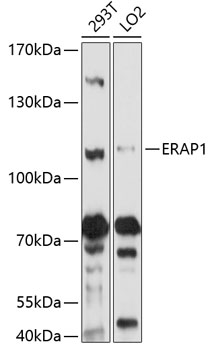 Western blot analysis of extracts of various cell lines using ERAP1 Polyclonal Antibody at 1:1000 dilution.