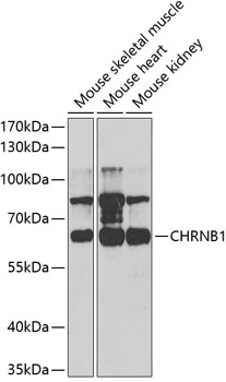 Western blot analysis of extracts of various cell lines using CHRNB1 Polyclonal Antibody at 1:1000 dilution.