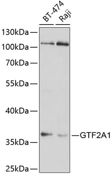 Western blot analysis of extracts of various cell lines using GTF2A1 Polyclonal Antibody at 1:1000 dilution.