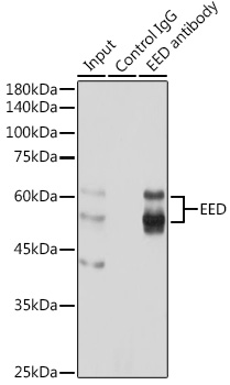 Immunoprecipitation analysis of 300ug extracts of HeLa cells using 3ug EED Polyclonal Antibody.Western blot was performed from the immunoprecipitate using EED Polyclonal Antibody at a dilution of 1:1000.