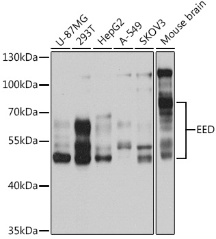 Western blot analysis of extracts of various cell lines using EED Polyclonal Antibody at 1:1000 dilution.