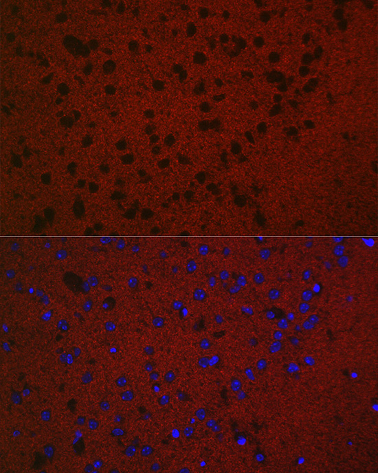 Immunofluorescence analysis of Mouse brain using RAB3A Polyclonal Antibody at dilution of 1:50. Blue: DAPI for nuclear staining.