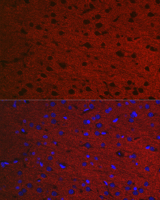 Immunofluorescence analysis of Rat brain using RAB3A Polyclonal Antibody at dilution of 1:50. Blue: DAPI for nuclear staining.