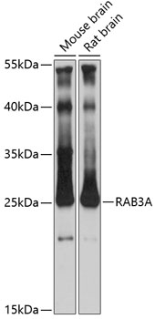 Western blot analysis of extracts of various cell lines using RAB3A Polyclonal Antibody at 1:3000 dilution.