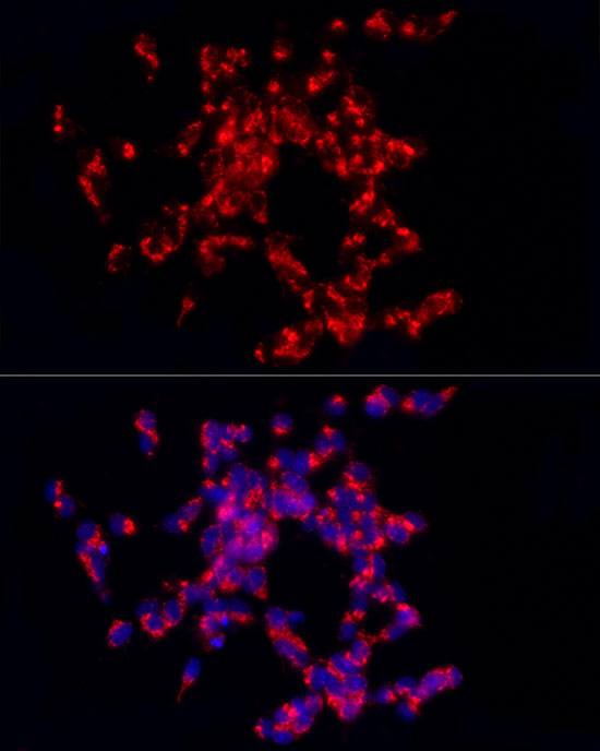 Immunofluorescence analysis of SH-SY5Y cells using CART Polyclonal Antibody at dilution of 1:200 (40x lens). Blue: DAPI for nuclear staining.