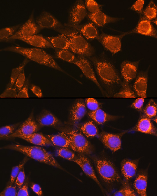 Immunofluorescence analysis of NIH-3T3 cells using CFP Polyclonal Antibody at dilution of 1:100 (40x lens). Blue: DAPI for nuclear staining.