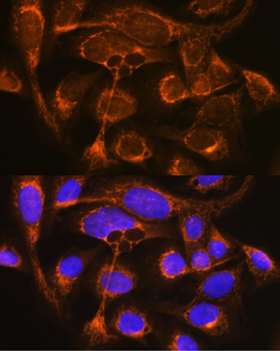 Immunofluorescence analysis of U2OS cells using CFP Polyclonal Antibody at dilution of 1:100 (40x lens). Blue: DAPI for nuclear staining.