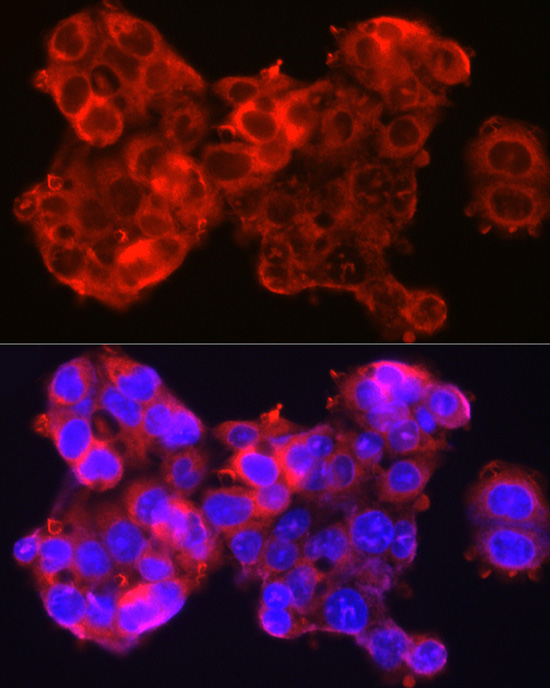 Immunofluorescence analysis of HepG2 cells using SSCA1/SerpinB3 Polyclonal Antibody at dilution of 1:100 (40x lens). Blue: DAPI for nuclear staining.