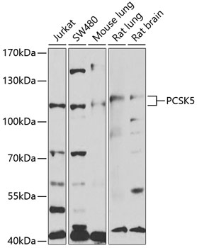 Western blot analysis of extracts of various cell lines using PCSK5 Polyclonal Antibody at 1:1000 dilution.