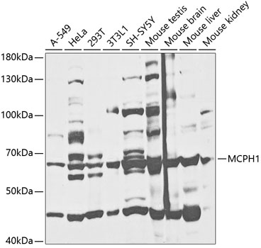 Western blot analysis of extracts of various cell lines using MCPH1 Polyclonal Antibody at 1:1000 dilution.