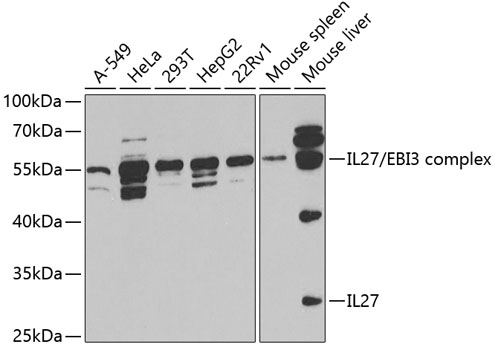 Western blot analysis of extracts of various cell lines using IL27 Polyclonal Antibody at 1:1000 dilution.