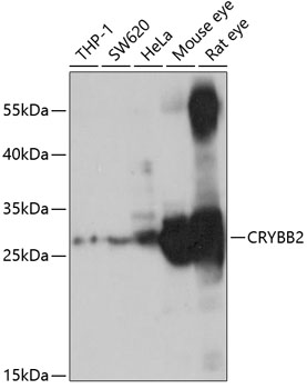 Western blot analysis of extracts of various cell lines using CRYBB2 Polyclonal Antibody at 1:1000 dilution.