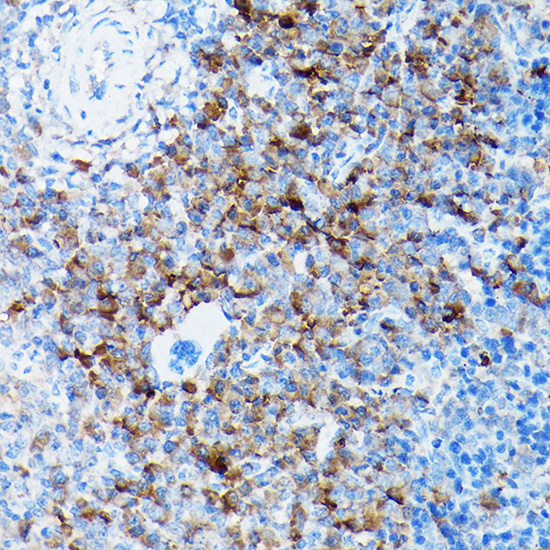 Immunohistochemistry of paraffin-embedded mouse spleen using SLC8A1 Polyclonal Antibody at dilution of 1:100 (40x lens).Perform high pressure antigen retrieval with 10 mM citrate buffer pH 6.0 before commencing with IHC staining protocol.