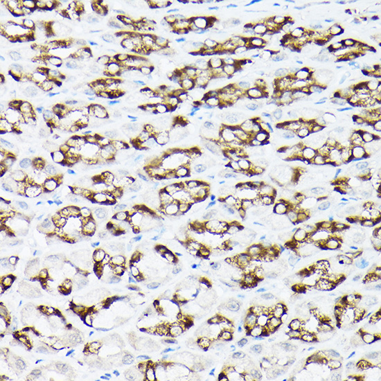 Immunohistochemistry of paraffin-embedded rat stomach using SLC8A1 Polyclonal Antibody at dilution of 1:100 (40x lens).Perform high pressure antigen retrieval with 10 mM citrate buffer pH 6.0 before commencing with IHC staining protocol.