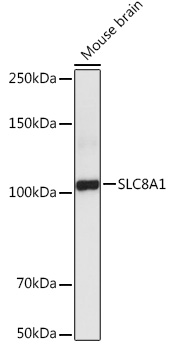 Western blot analysis of extracts of Mouse brain  using SLC8A1 Polyclonal Antibody at 1:5000 dilution.