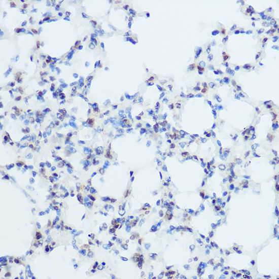 Immunohistochemistry of paraffin-embedded mouse lung using THRA Polyclonal Antibody at dilution of 1:50 (40x lens).Perform high pressure antigen retrieval with 10 mM citrate buffer pH 6.0 before commencing with IHC staining protocol.