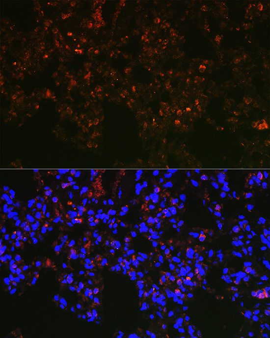 Immunofluorescence analysis of rat lung cells using NAPSA Polyclonal Antibody at dilution of 1:100 (40x lens). Blue: DAPI for nuclear staining.