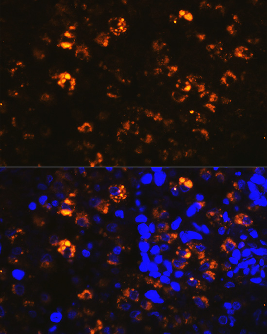 Immunofluorescence analysis of human lung cancer cells using NAPSA Polyclonal Antibody at dilution of 1:100 (40x lens). Blue: DAPI for nuclear staining.