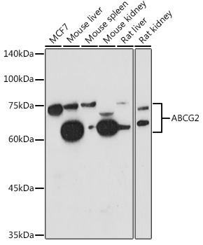 Western blot analysis of extracts of various cell lines using ABCG2 Polyclonal Antibody at 1:1000 dilution.