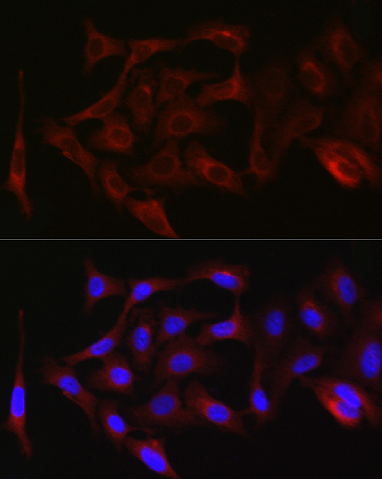 Immunofluorescence analysis of A-549 cells using PKC zeta Polyclonal Antibody at dilution of 1:100 (40x lens). Blue: DAPI for nuclear staining.