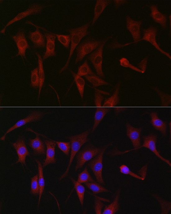 Immunofluorescence analysis of NIH/3T3 cells using PKC zeta Polyclonal Antibody at dilution of 1:100 (40x lens). Blue: DAPI for nuclear staining.