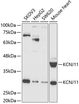 Western blot analysis of extracts of various cell lines using KCNJ11 Polyclonal Antibody at 1:1000 dilution.