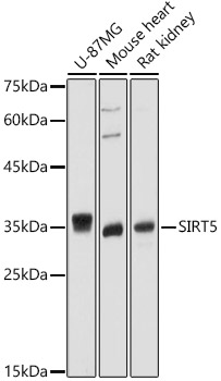 Western blot analysis of extracts of various cell lines using SIRT5 Polyclonal Antibody at 1:1000 dilution.