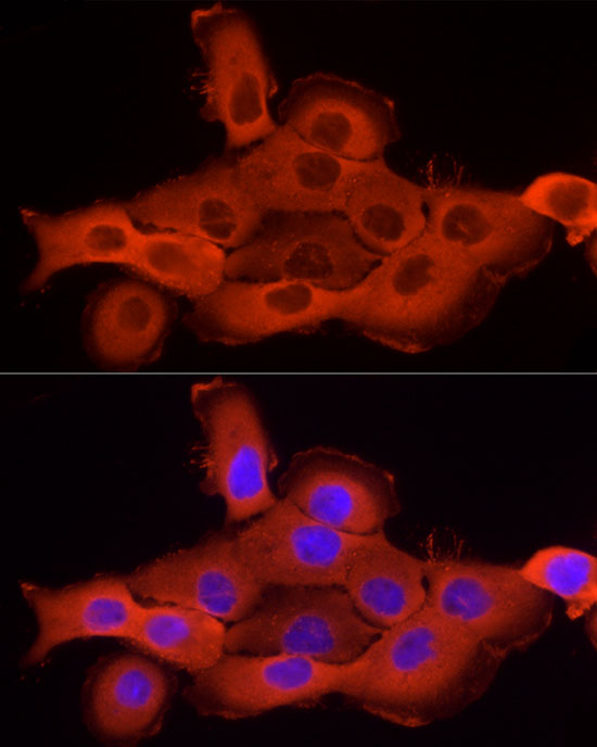 Immunofluorescence analysis of A-431 using Cortactin Polyclonal Antibody at dilution of 1:20 (40x lens). Blue: DAPI for nuclear staining.