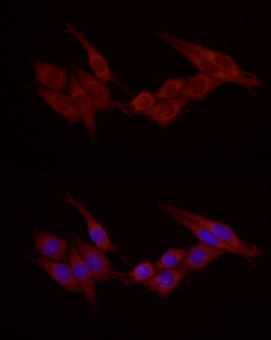 Immunofluorescence analysis of PC-12 using Cortactin Polyclonal Antibody at dilution of 1:20 (40x lens). Blue: DAPI for nuclear staining.