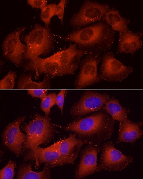 Immunofluorescence analysis of HeLa using Cortactin Polyclonal Antibody at dilution of 1:20 (40x lens). Blue: DAPI for nuclear staining.