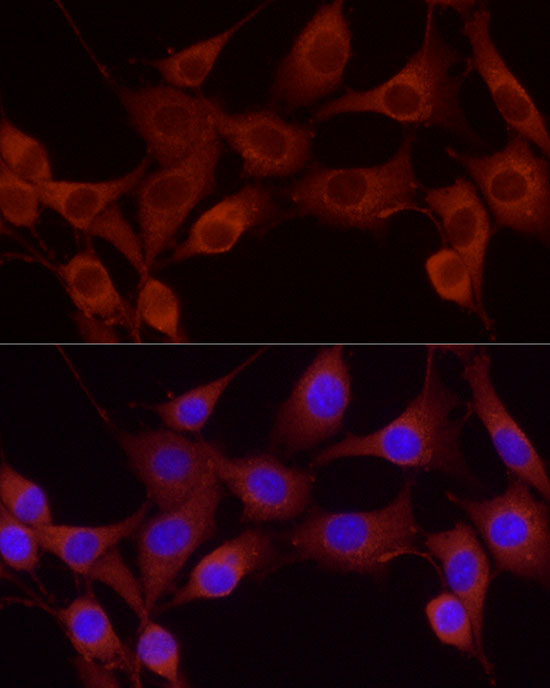 Immunofluorescence analysis of NIH-3T3 using Cortactin Polyclonal Antibody at dilution of 1:20 (40x lens). Blue: DAPI for nuclear staining.