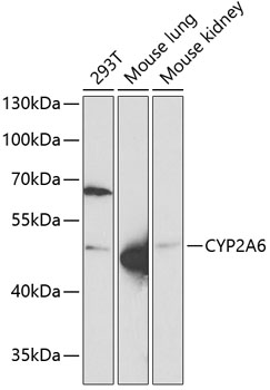 Western blot analysis of extracts of various cell lines using CYP2A6 Polyclonal Antibody at 1:1000 dilution.