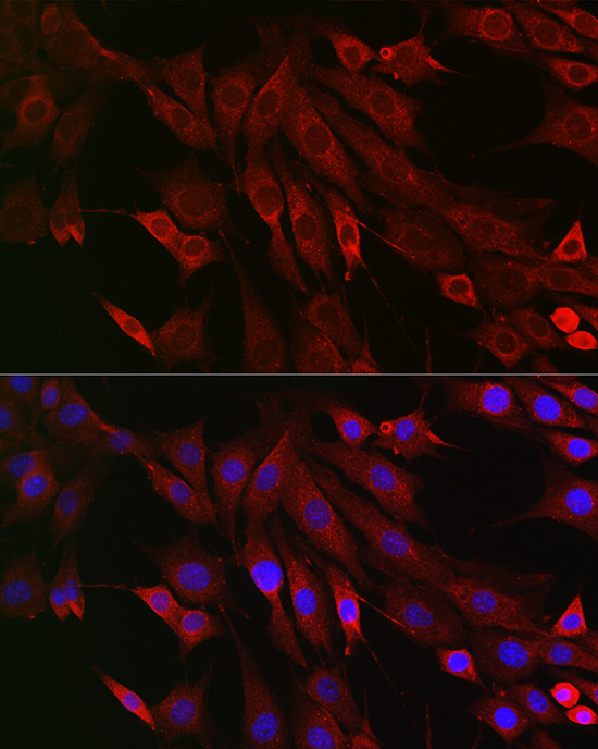 Immunofluorescence analysis of NIH/3T3 cells using PTPIP51/RMDN3 Polyclonal Antibody at dilution of 1:200 (40x lens). Blue: DAPI for nuclear staining.