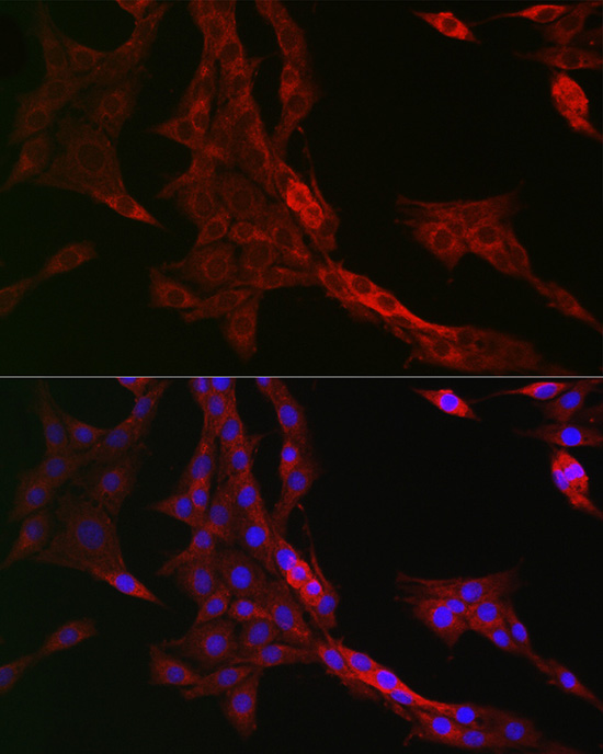 Immunofluorescence analysis of PC-12 cells using PTPIP51/RMDN3 Polyclonal Antibody at dilution of 1:200 (40x lens). Blue: DAPI for nuclear staining.