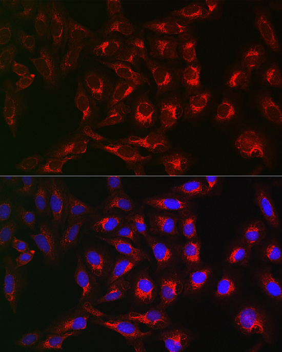 Immunofluorescence analysis of U2OS cells using PTPIP51/RMDN3 Polyclonal Antibody at dilution of 1:200 (40x lens). Blue: DAPI for nuclear staining.