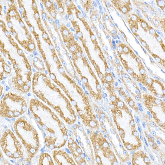 Immunohistochemistry of paraffin-embedded mouse kidney using PTPIP51/RMDN3 Polyclonal Antibody at dilution of 1:100 (40x lens).Perform high pressure antigen retrieval with 10 mM citrate buffer pH 6.0 before commencing with IHC staining protocol.