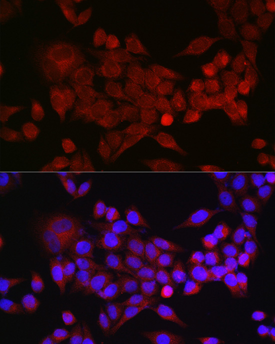 Immunofluorescence analysis of HeLa cells using Inhibin beta A Polyclonal Antibody at dilution of 1:50 (40x lens). Blue: DAPI for nuclear staining.