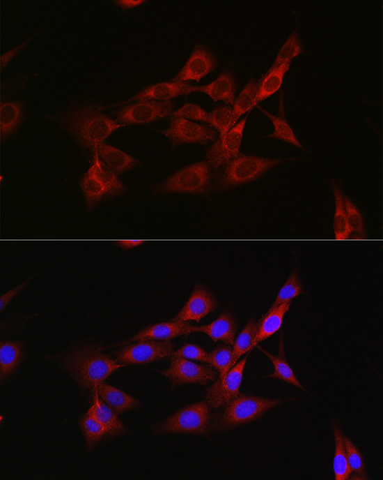 Immunofluorescence analysis of NIH/3T3 cells using Inhibin beta A Polyclonal Antibody at dilution of 1:50 (40x lens). Blue: DAPI for nuclear staining.