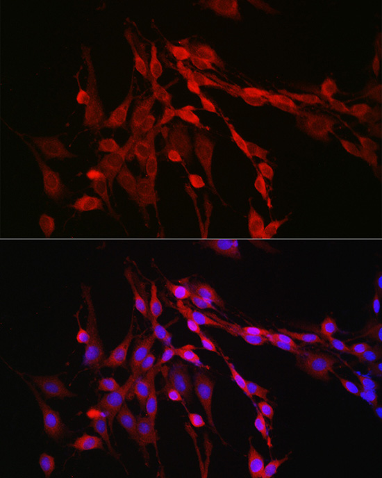 Immunofluorescence analysis of PC-12 cells using Inhibin beta A Polyclonal Antibody at dilution of 1:50 (40x lens). Blue: DAPI for nuclear staining.