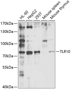 Western blot analysis of extracts of various cell lines using TLR10 Polyclonal Antibody at 1:1000 dilution.