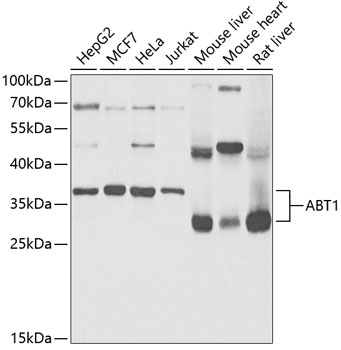 Western blot analysis of extracts of various cell lines using ABT1 Polyclonal Antibody at 1:1000 dilution.