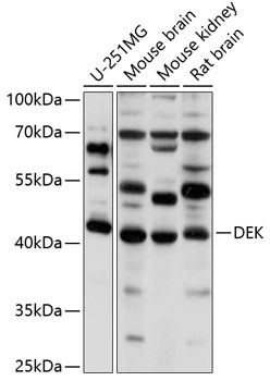 Western blot analysis of extracts of various cell lines using DEK Polyclonal Antibody at 1:1000 dilution.