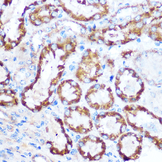 Immunohistochemistry of paraffin-embedded mouse kidney using MAP4 Polyclonal Antibody at dilution of 1:100 (40x lens).Perform microwave antigen retrieval with 10 mM Tris/EDTA buffer pH 9.0 before commencing with IHC staining protocol.